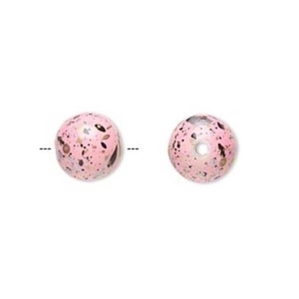 20 Retro Pink Silver Gold Black Paint Spattered 10mm Round Beads